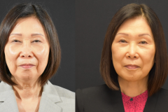 Lower-Face-Necklift-Before-and-After