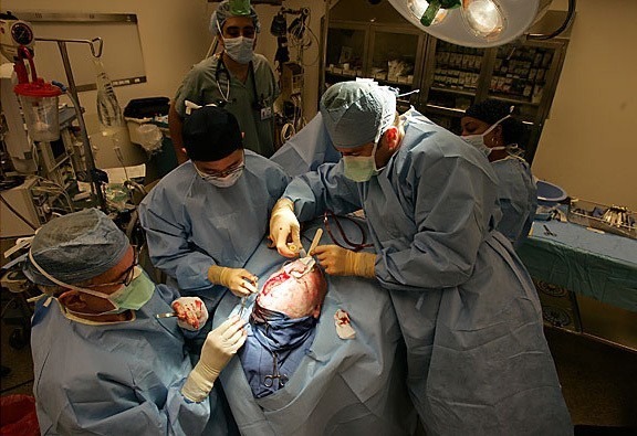operation mend rhinoplasty airway reconstruction