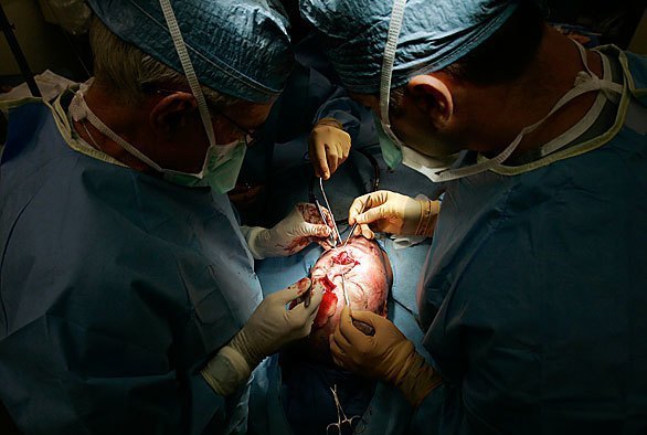 rhinoplasty airway reconstruction