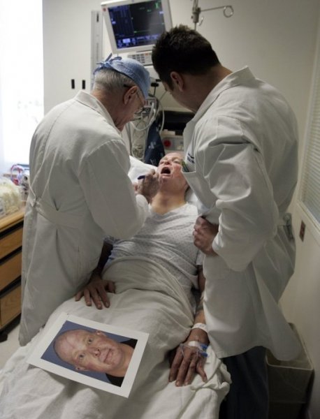 rhinoplasty surgeon airway reconstruction