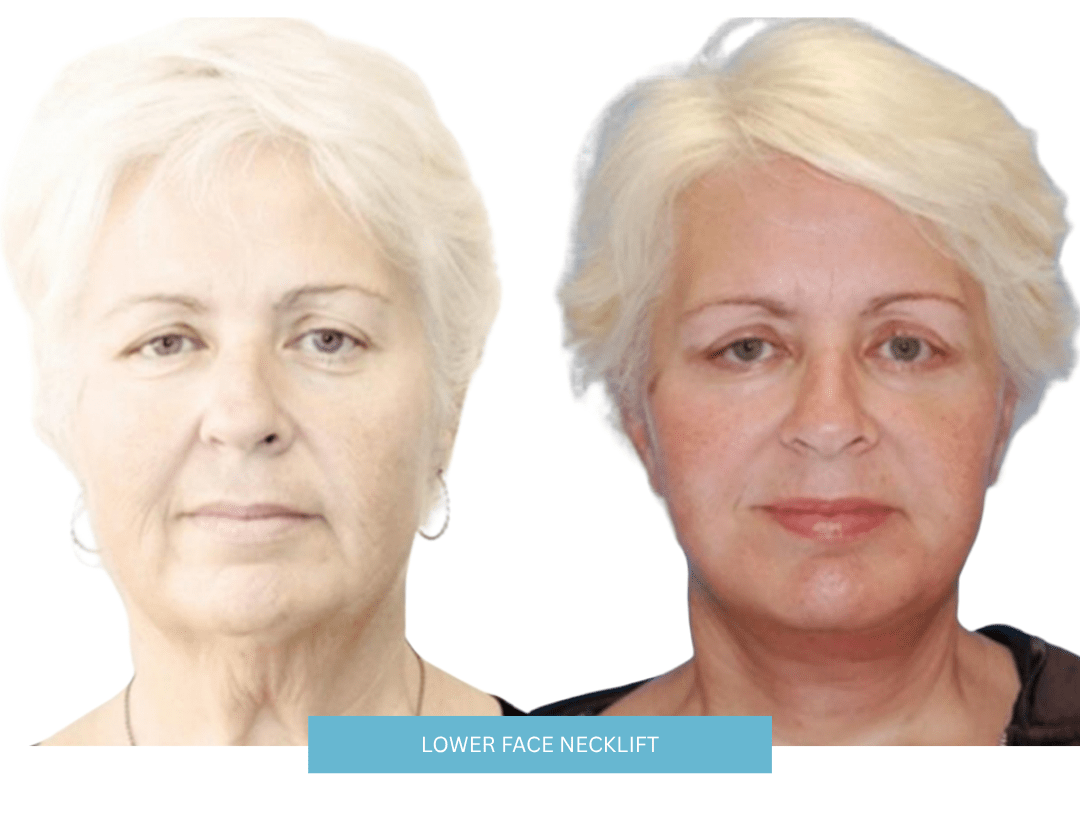 Untitled design - 2025-06-12T042342.950