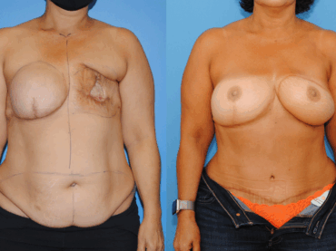 October is Breast Cancer Awareness Month